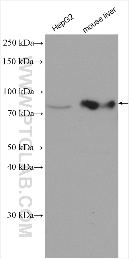 PTH1R antibody (24275-1-AP) | Proteintech