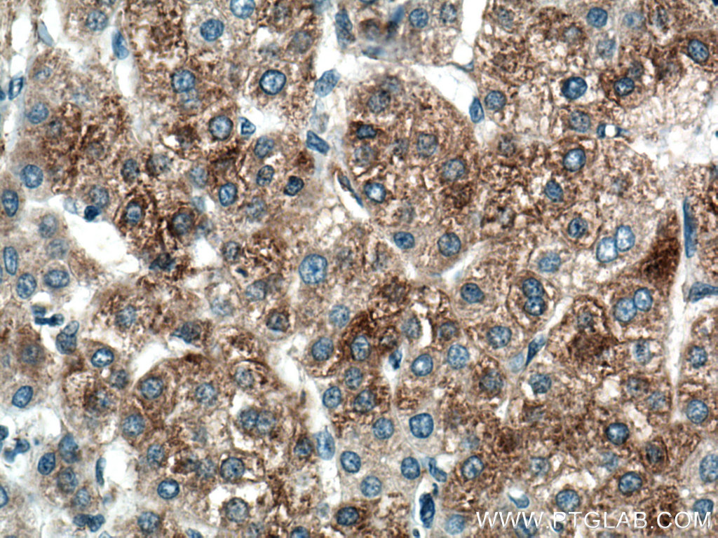 RPL5 Antibody 15430-1-AP | Proteintech