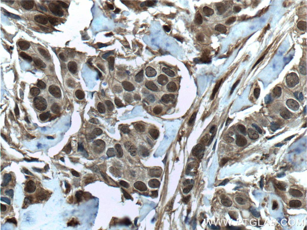 S100A11 antibody validated in IHC