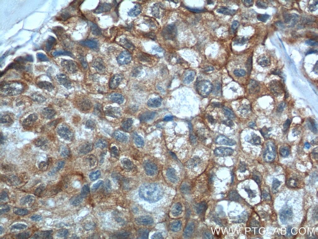 S100A16 antibody (11456-1-AP) | Proteintech