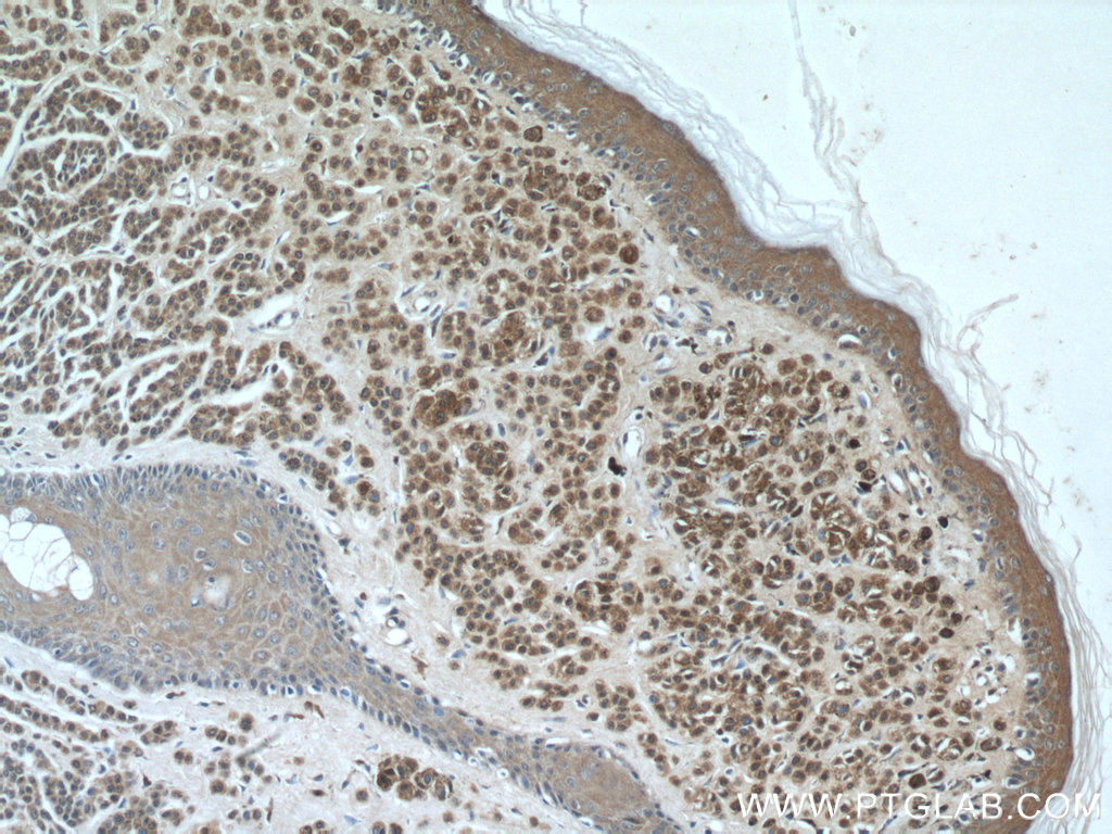 S100 Beta Antibody 1 Ig Proteintech