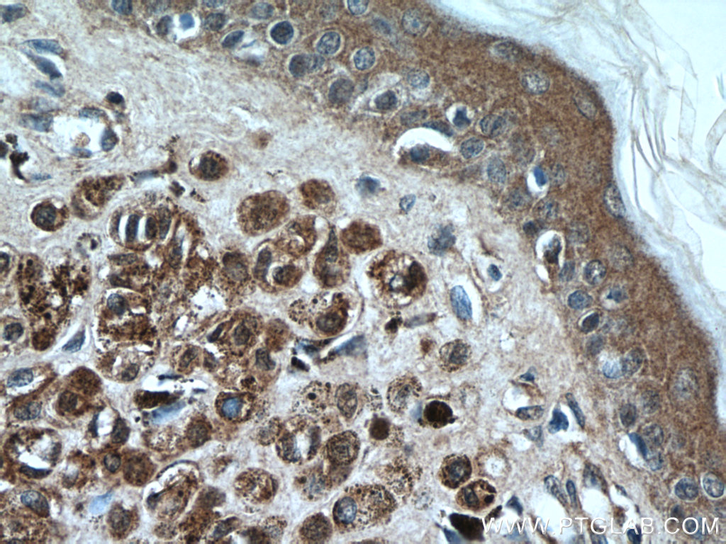 S100 Beta Antibody 1 Ig Proteintech