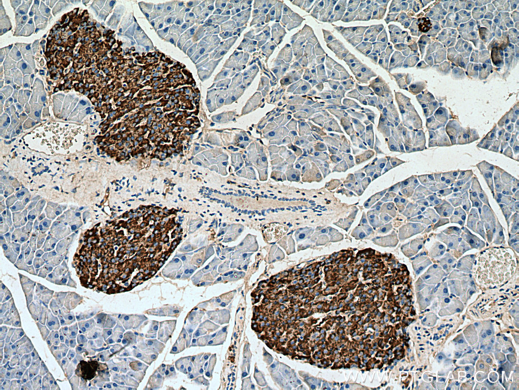 Secretogranin III Antibody 10954-1-AP | Proteintech