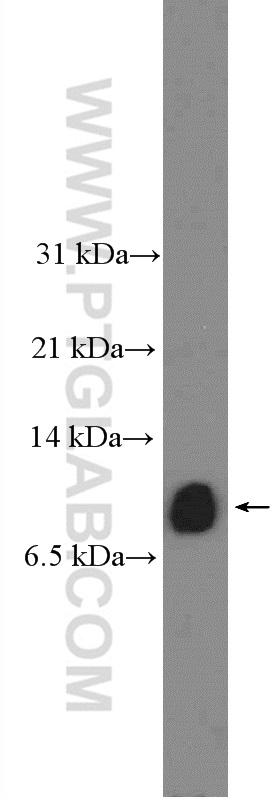 secondary antibody dilution western blot