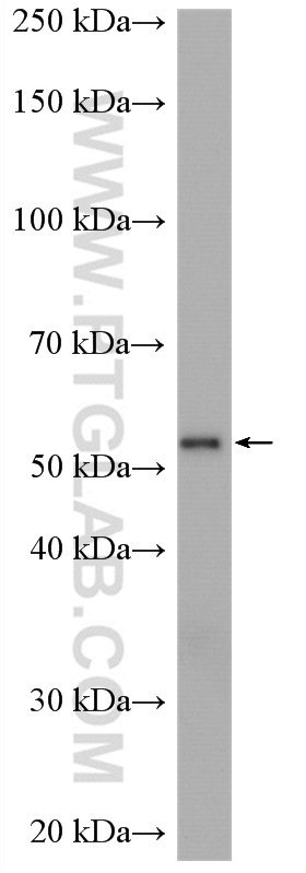 Glut3 Antibody 20403 1 Ap Proteintech