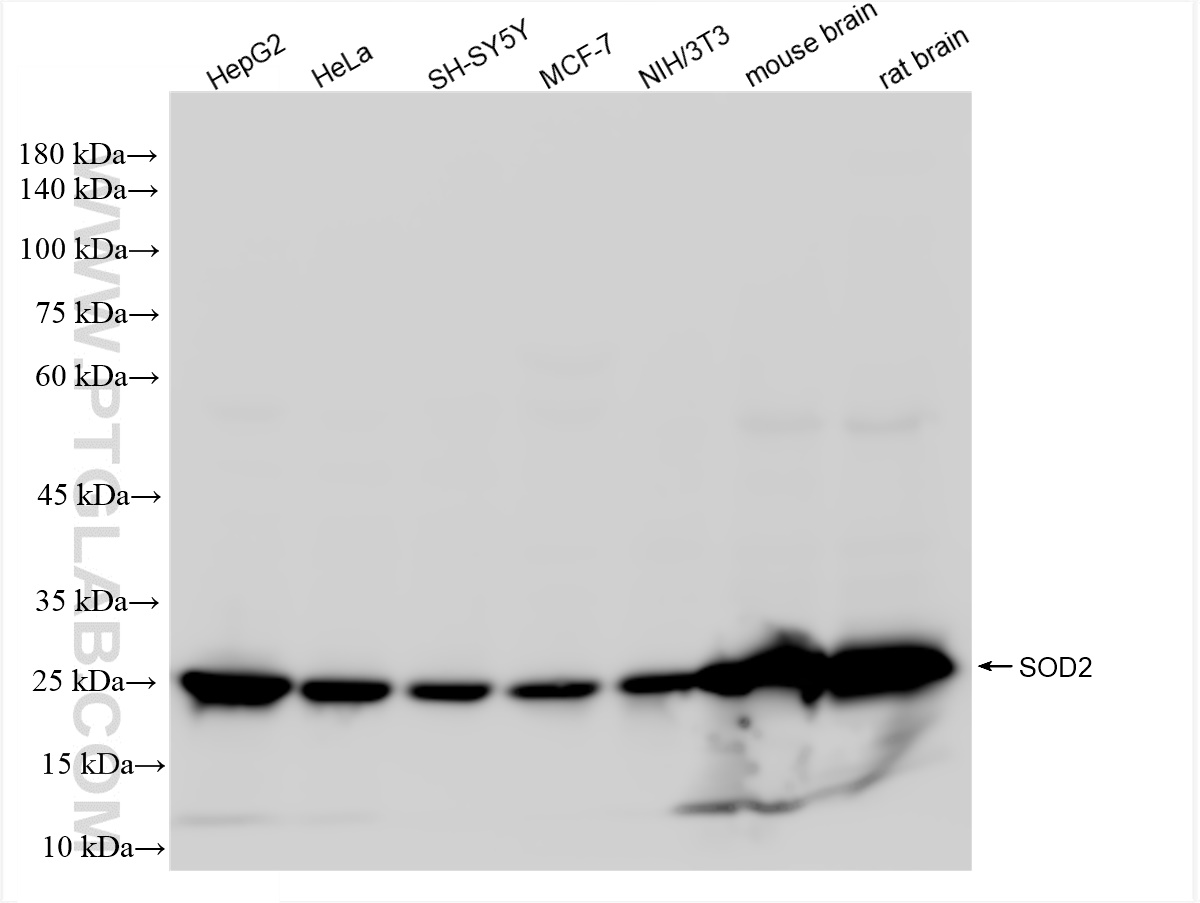 SOD2 antibody (83519-3-RR) | Proteintech