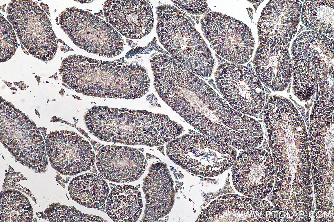 STRAP antibody (18277-1-AP) | Proteintech