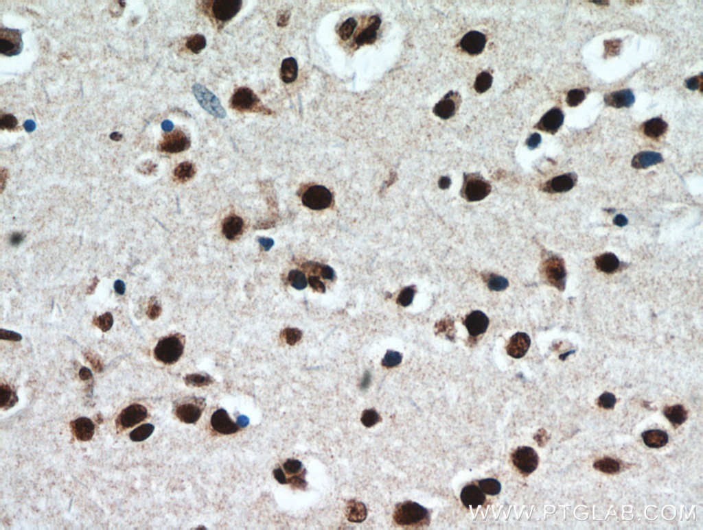 IHC of paraffin-embedded human brain using TDP43 antibody, 10782-2-AP 