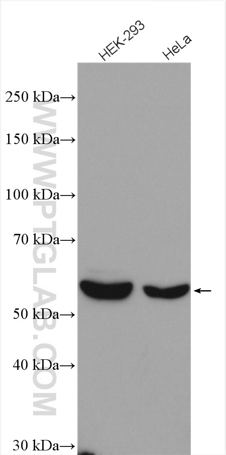 TBC1D24 antibody (25254-1-AP) | Proteintech