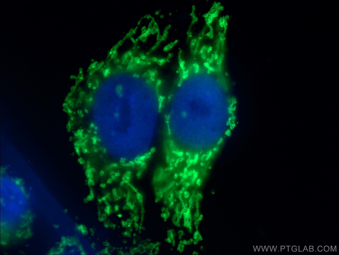 IF staining of HepG2 cells using 14528-1-AP