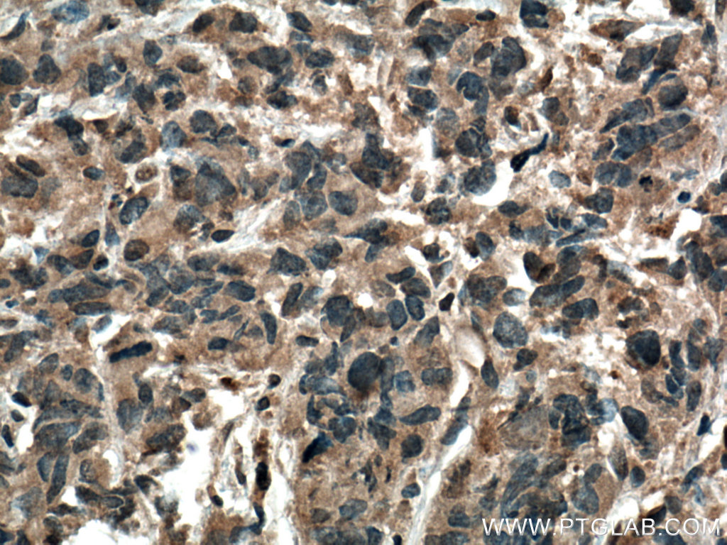 Ttbk2 Antibody 15072 1 Ap Proteintech