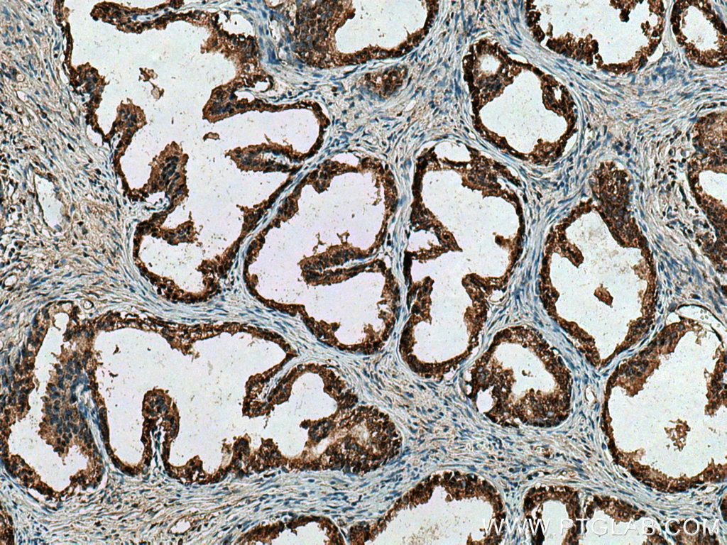 Ttbk2 Antibody 15072 1 Ap Proteintech