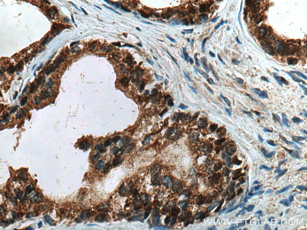 Ttbk2 Antibody 15072 1 Ap Proteintech