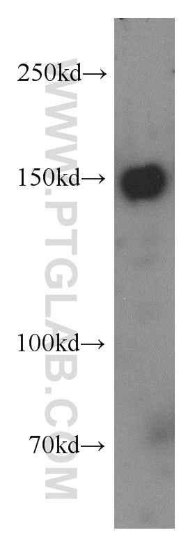 Ttbk2 Antibody 15072 1 Ap Proteintech