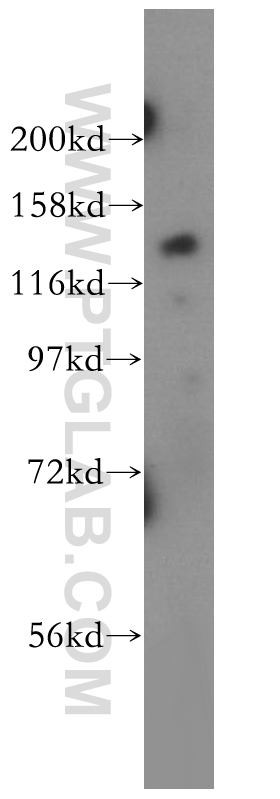 Ttbk2 Antibody 15072 1 Ap Proteintech