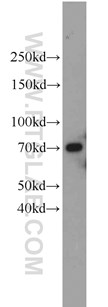 UBQLN2 antibody validated in WB