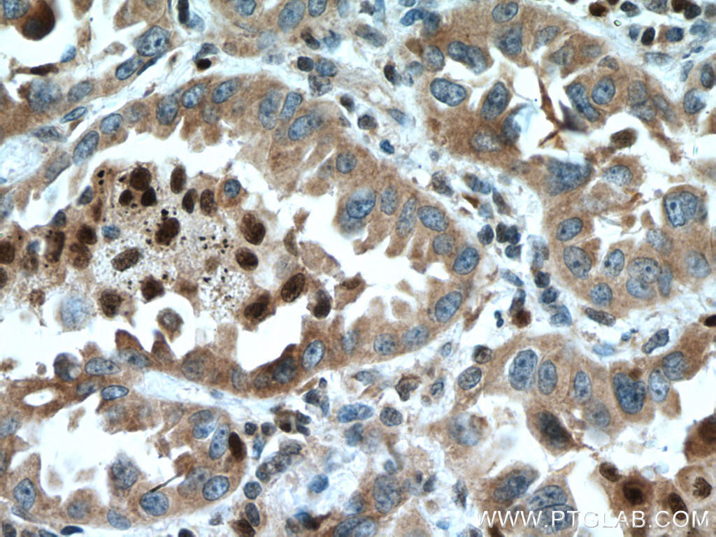 UFM1 antibody (15883-1-AP) | Proteintech