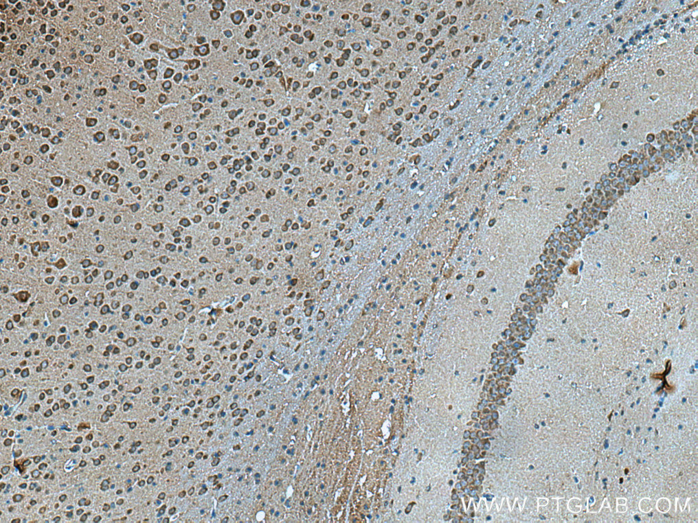 VSNL1 antibody (67134-1-Ig) | Proteintech