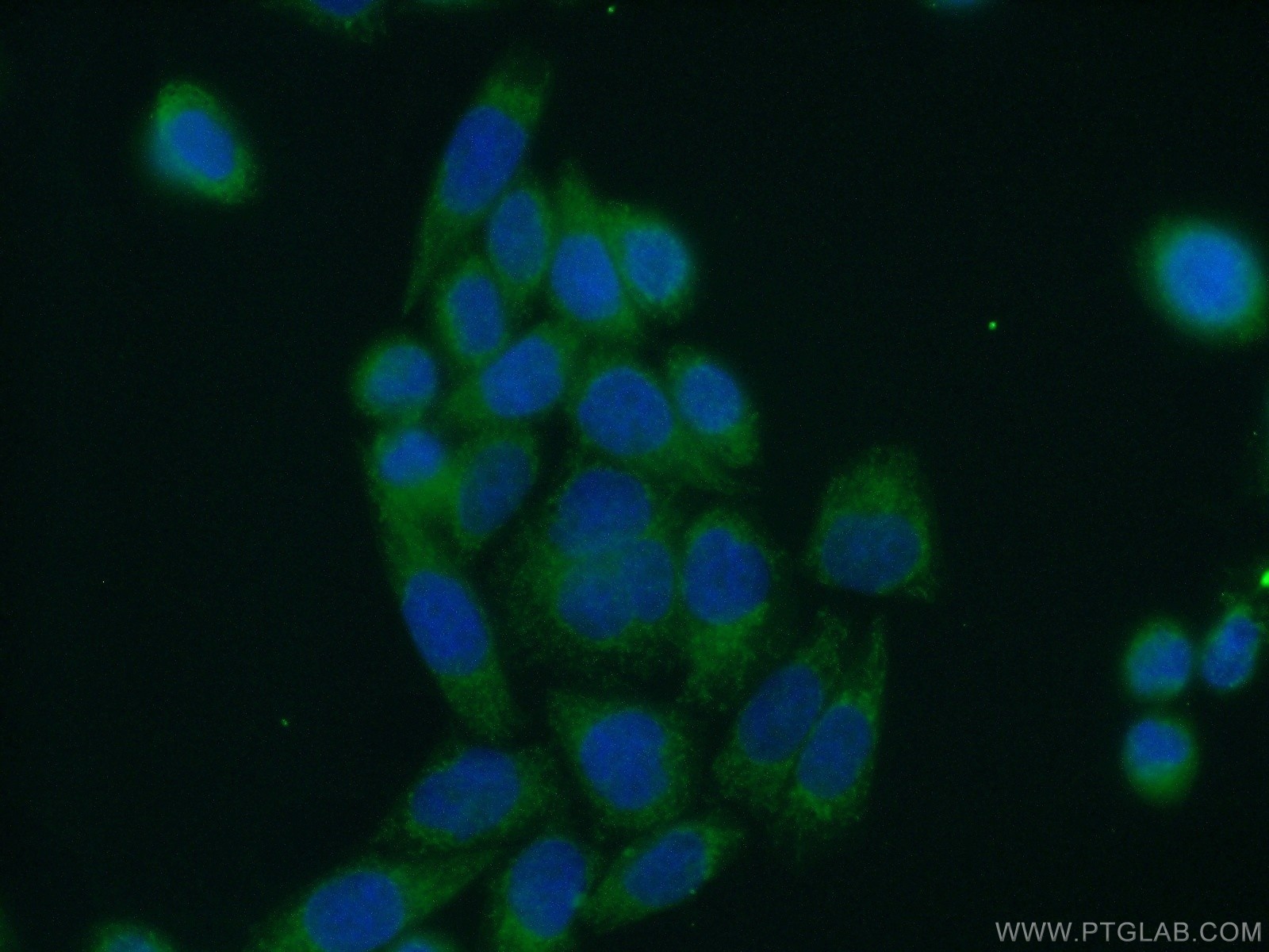 WNT10A antibody (26238-1-AP) | Proteintech