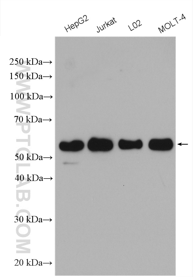 Wtap Antibody 10200 1 Ap Proteintech