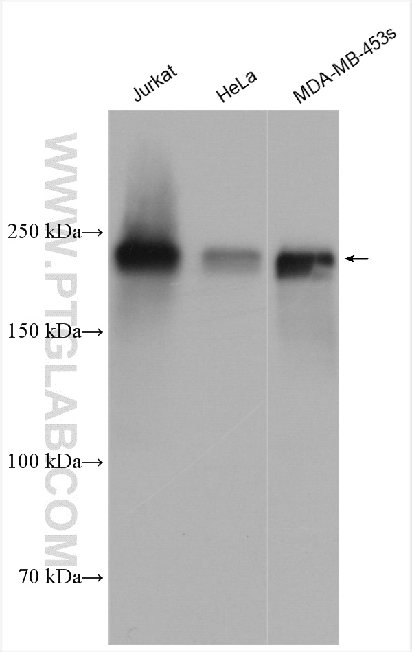 ZEB1 antibody (21544-1-AP) | Proteintech