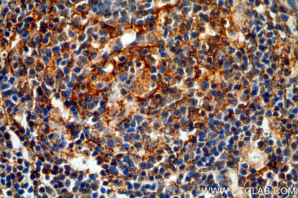 Immunohistochemical of paraffin-embedded human spleen using TNFR2 antibody