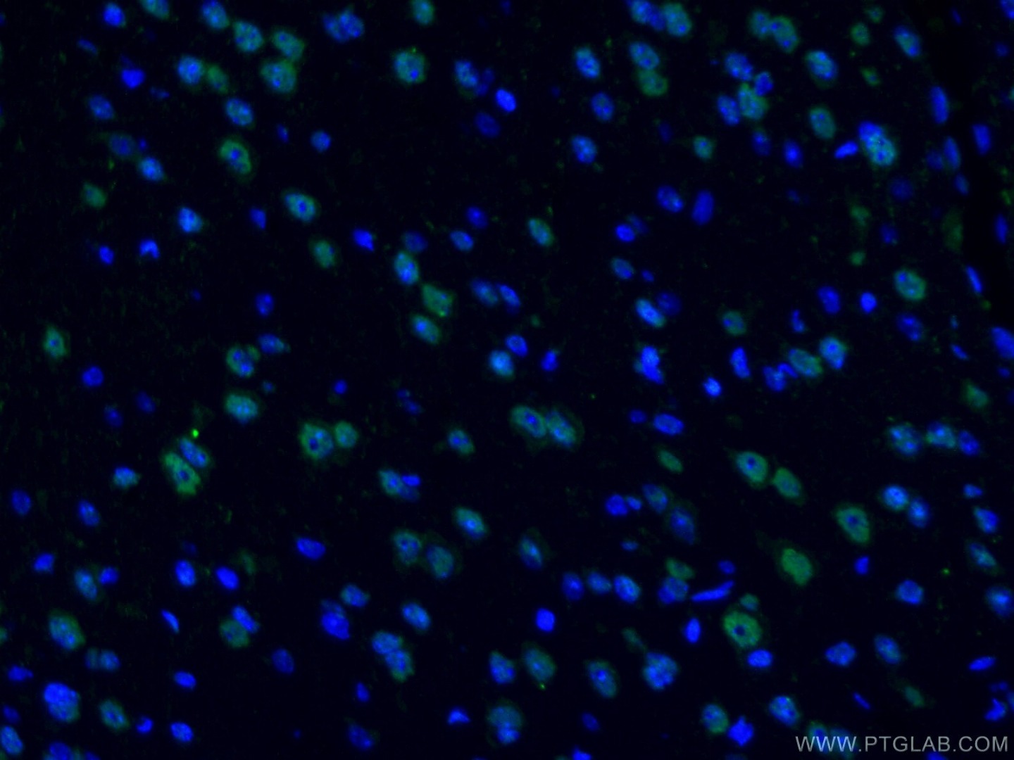 Immunofluorescent analysis of (4% PFA) fixed mouse brain tissue using TDP43/TARDBP antibody