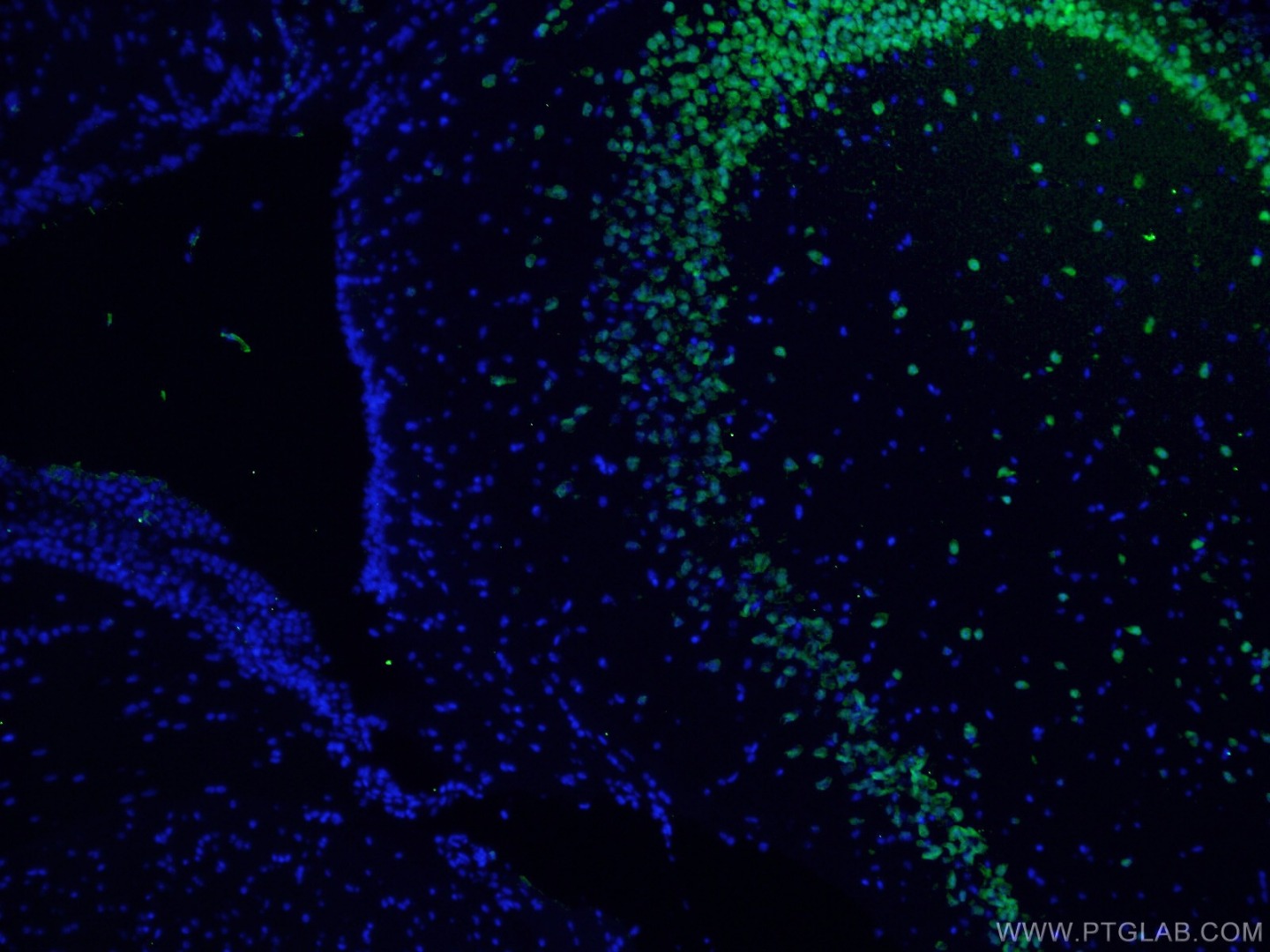 Immunofluorescent analysis of (4% PFA) fixed mouse brain tissue using NeuN antibody