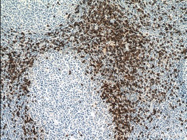 Immunohistochemistry of paraffin-embedded human tonsillitis tissue slide using CD8a antibody