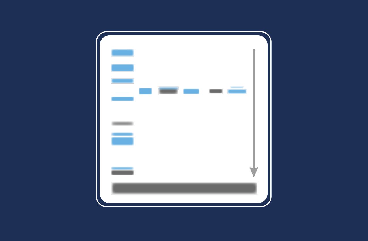 Tips for detecting phosphoproteins by western blot | Proteintech Group