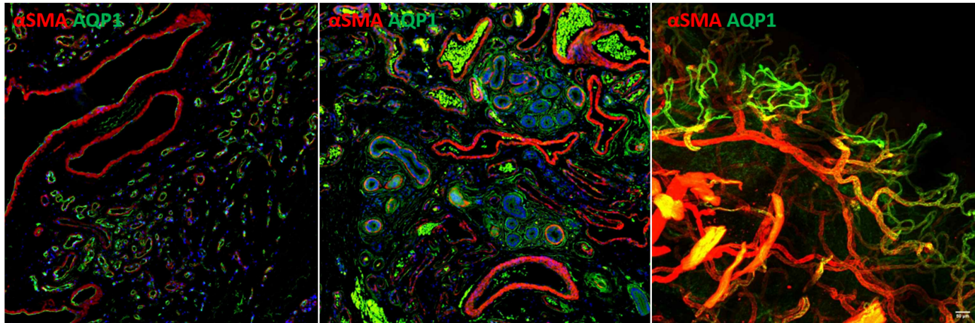 1: FFPE immunofluorescence (Proteintech primary antibodies + secondary antibodies) 2: FFPE immunofluorescence (Proteintech primay antibodies + Flexable)