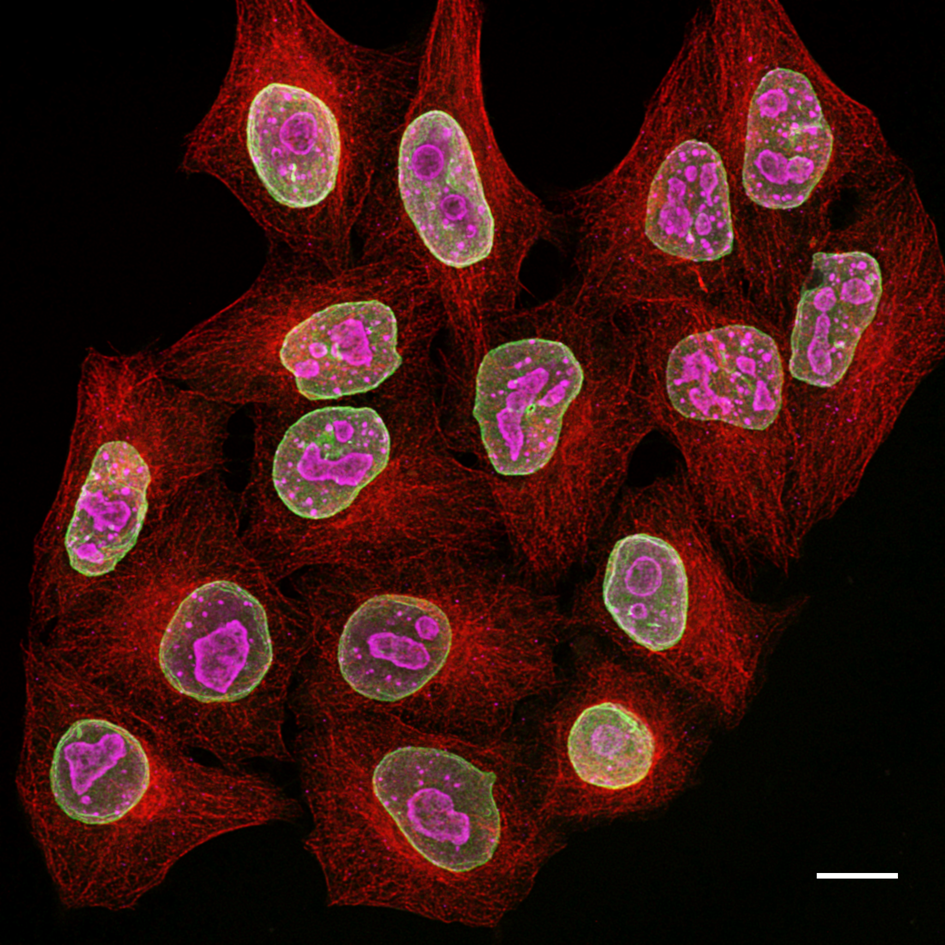 What Is One Step Immunostaining Proteintech Group