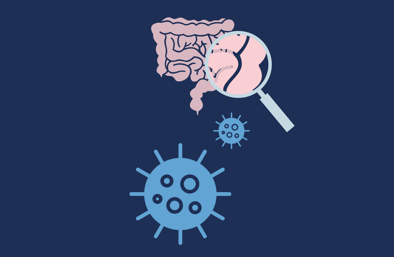 Long Term Effects Of COVID 19 On The Gastrointestinal System   23 01007 Covid Gut Blog Tile V6 2 