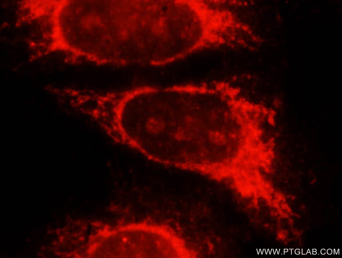 Beta Galactosidase Antibody | Proteintech Group