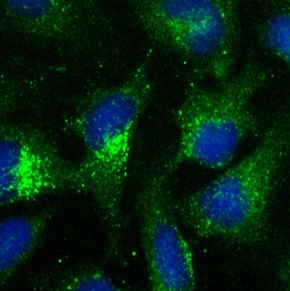 organelle markers exosome