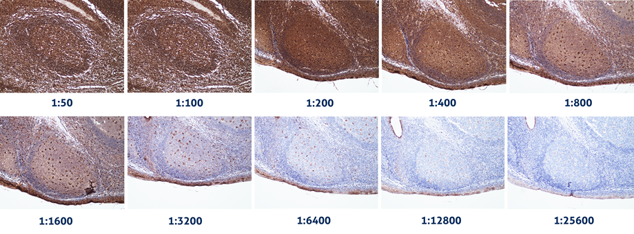 IHC analysis of human tonsillitis tissue stained with increasing dilutions of CD68 mouse monoclonal antibody