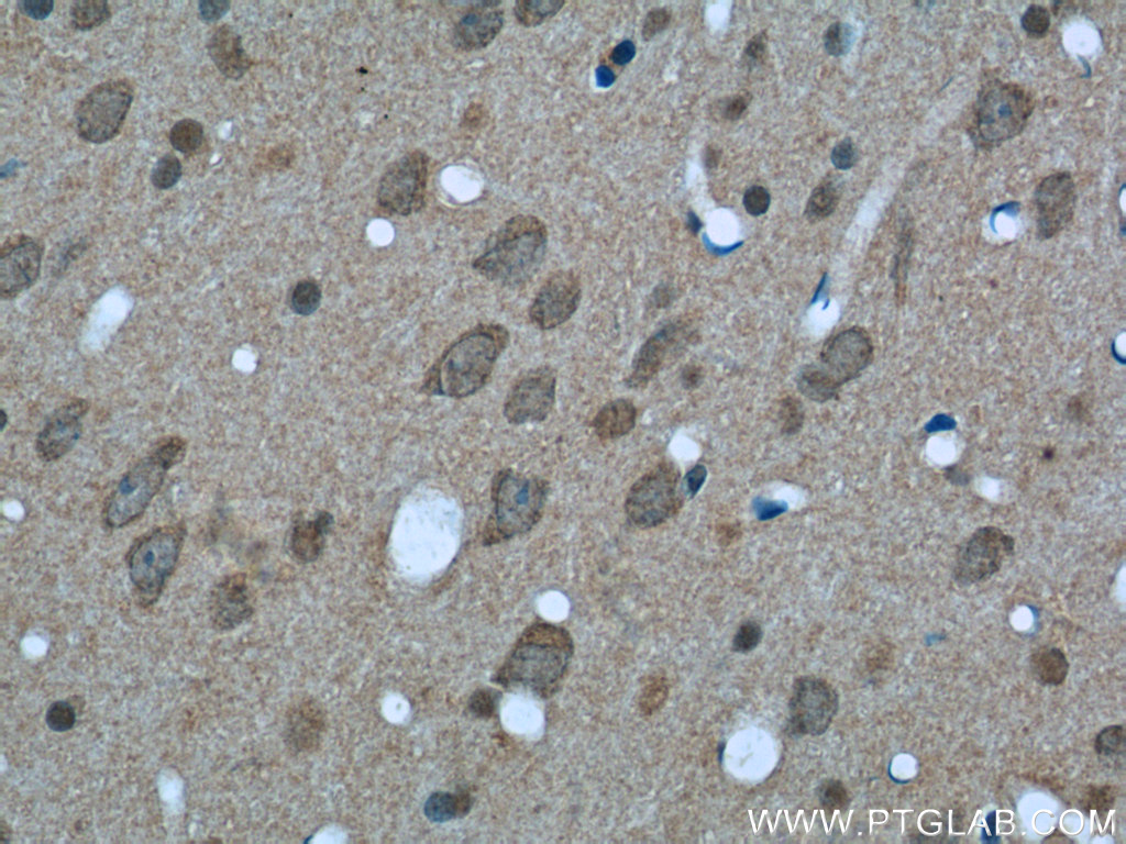 Immunohistochemistry (IHC) staining of rat brain tissue using 14-3-3 Monoclonal antibody (66061-1-Ig)