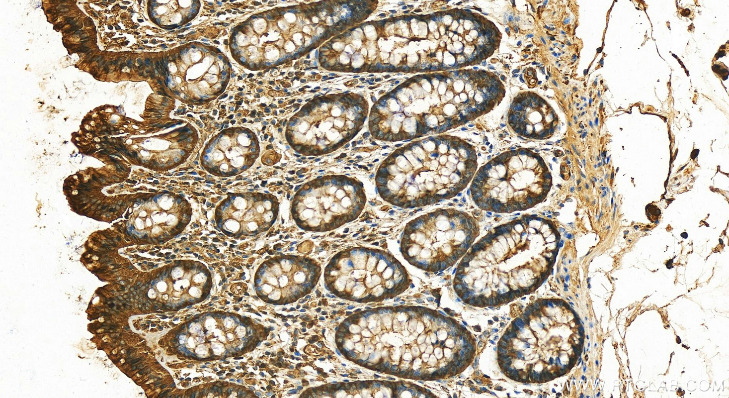 Immunohistochemistry (IHC) staining of human colon tissue using 14-3-3 Epsilon Polyclonal antibody (11648-2-AP)