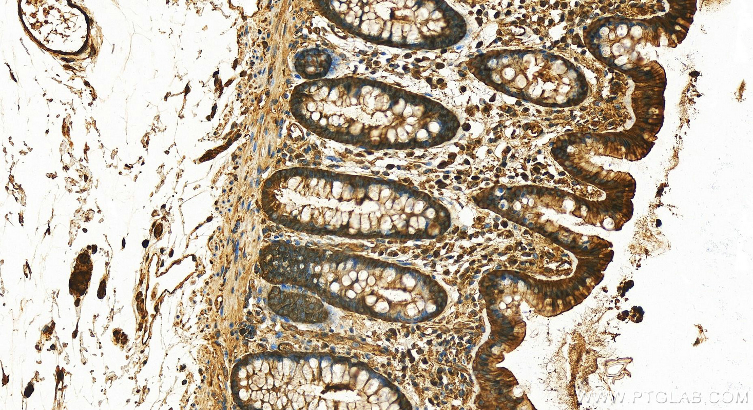 Immunohistochemistry (IHC) staining of human colon tissue using 14-3-3 Epsilon Polyclonal antibody (11648-2-AP)