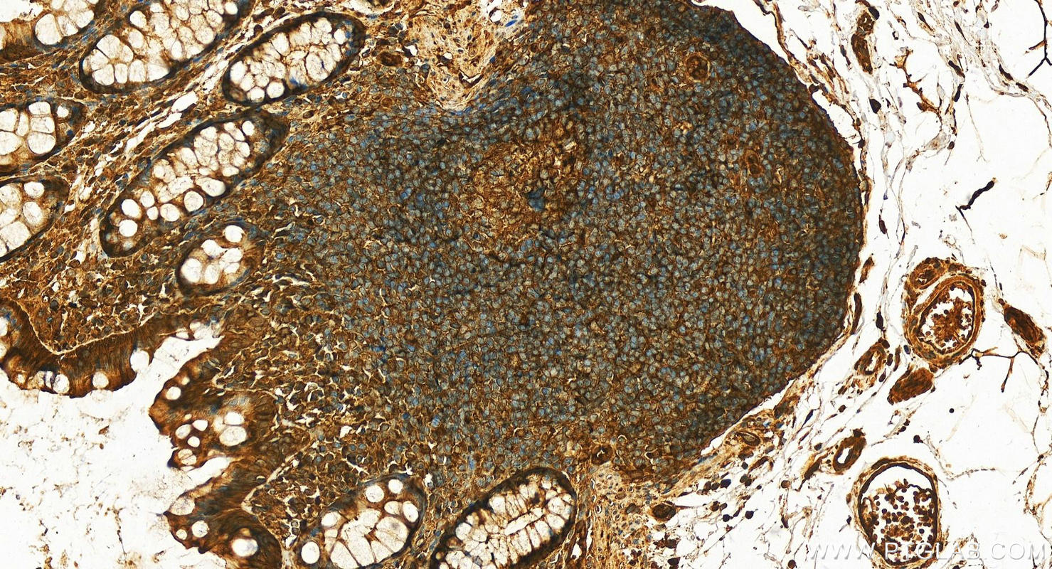 Immunohistochemistry (IHC) staining of human normal colon using 14-3-3 Epsilon Polyclonal antibody (11648-2-AP)