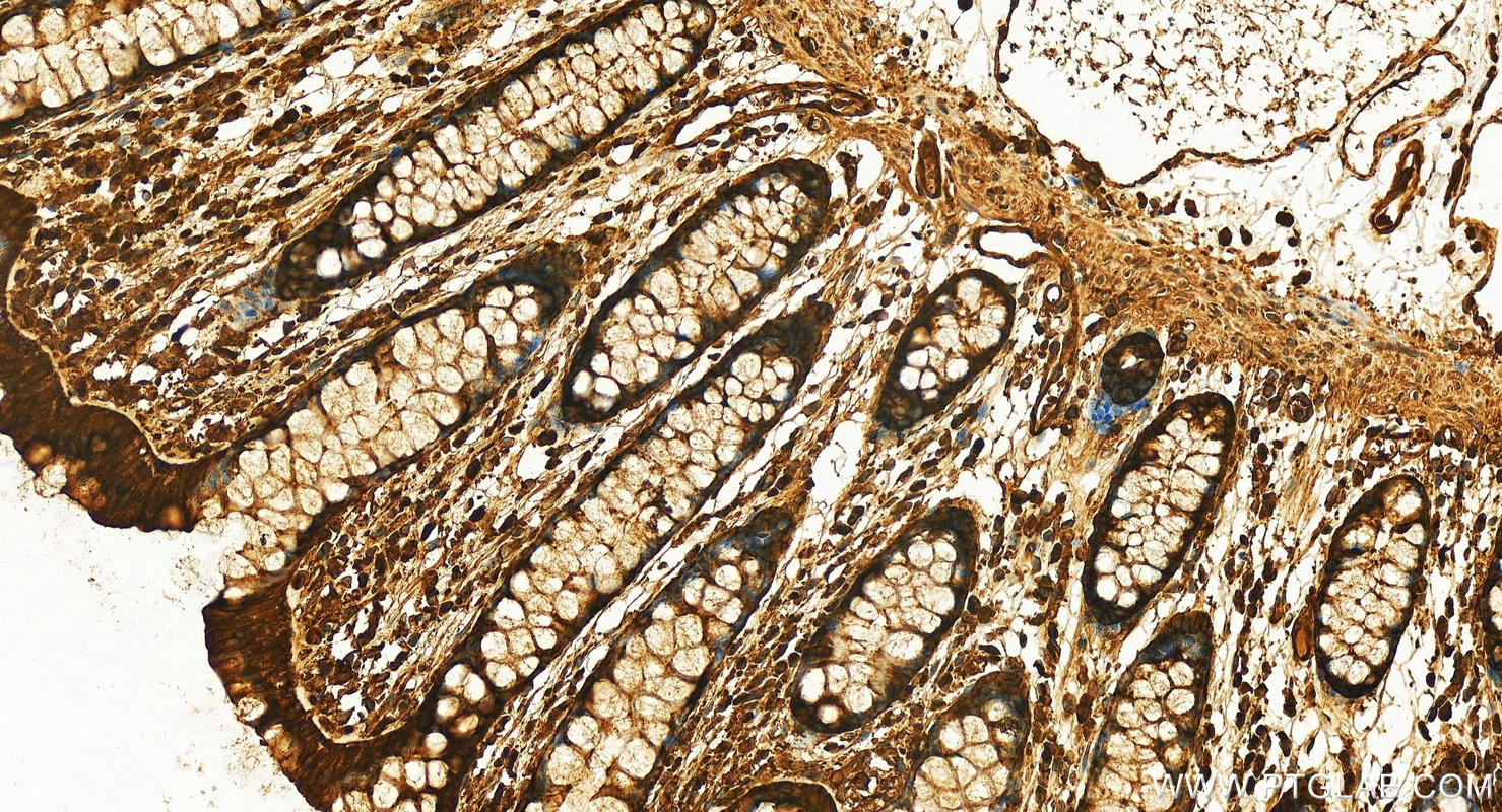 Immunohistochemistry (IHC) staining of human normal colon using 14-3-3 Epsilon Polyclonal antibody (11648-2-AP)