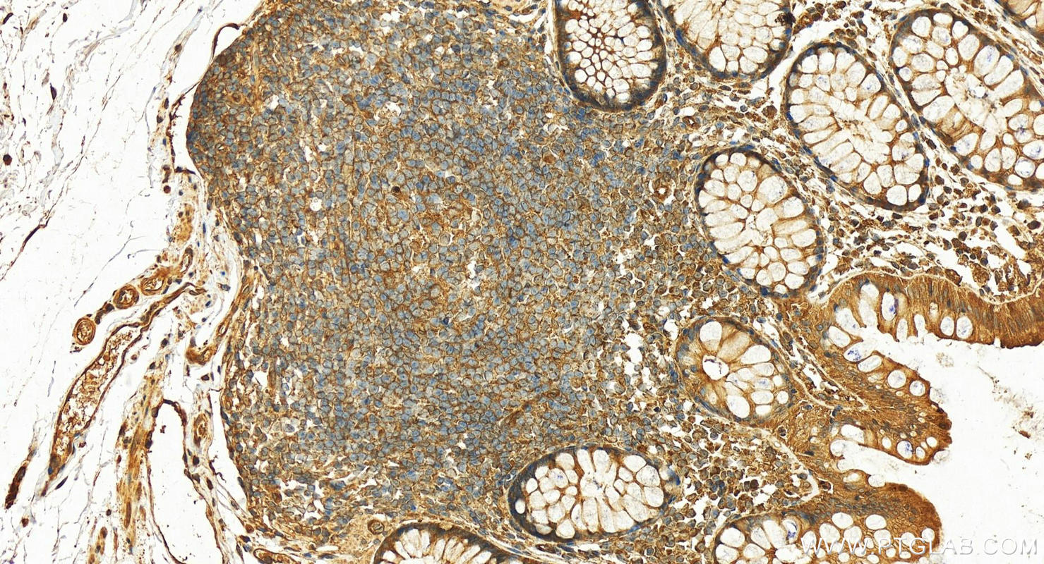 Immunohistochemistry (IHC) staining of human normal colon using 14-3-3 GAMMA-Specific Polyclonal antibody (12381-1-AP)