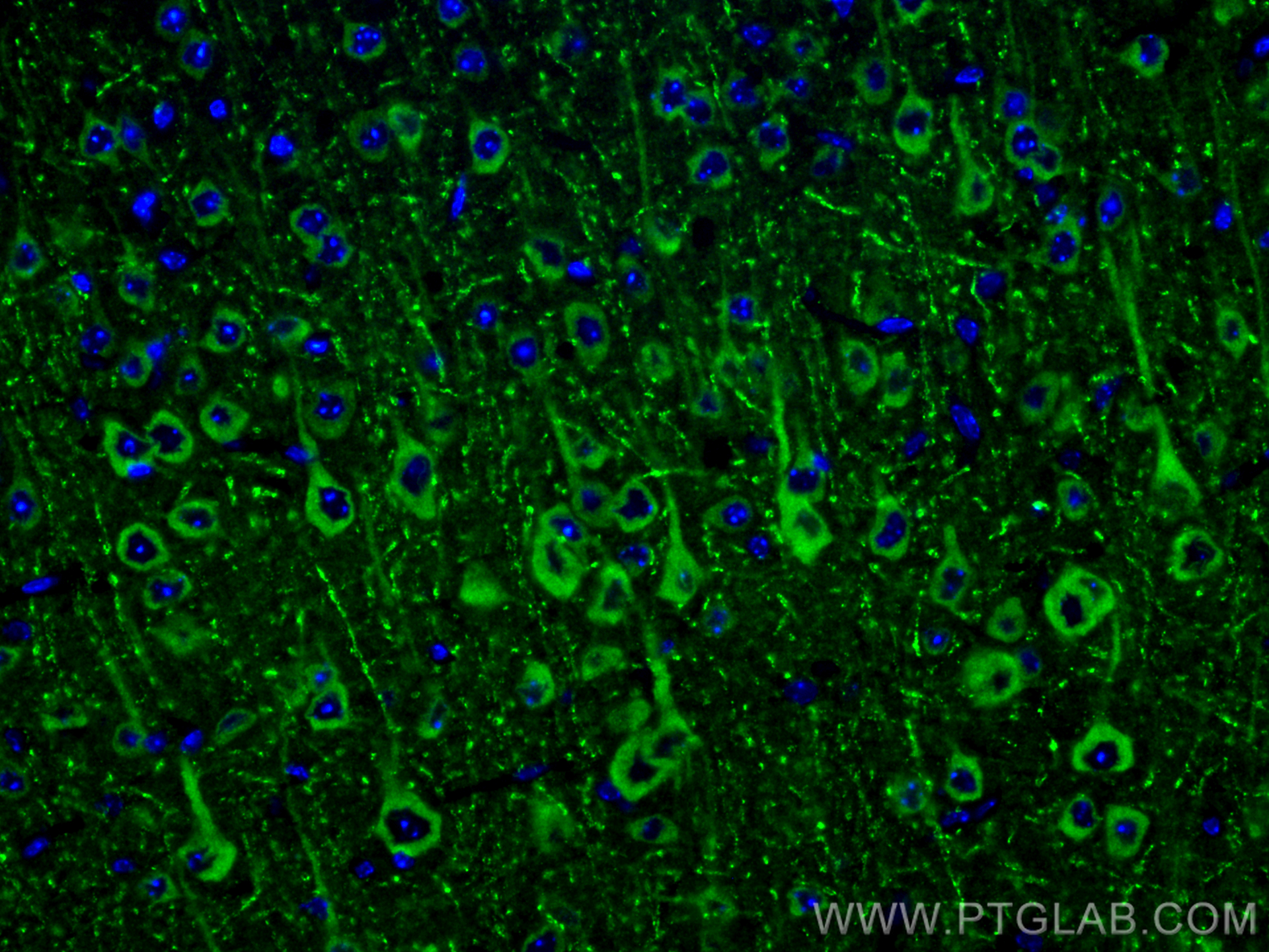 Immunofluorescence (IF) / fluorescent staining of mouse brain tissue using 14-3-3 GAMMA-Specific Polyclonal antibody (12381-1-AP)