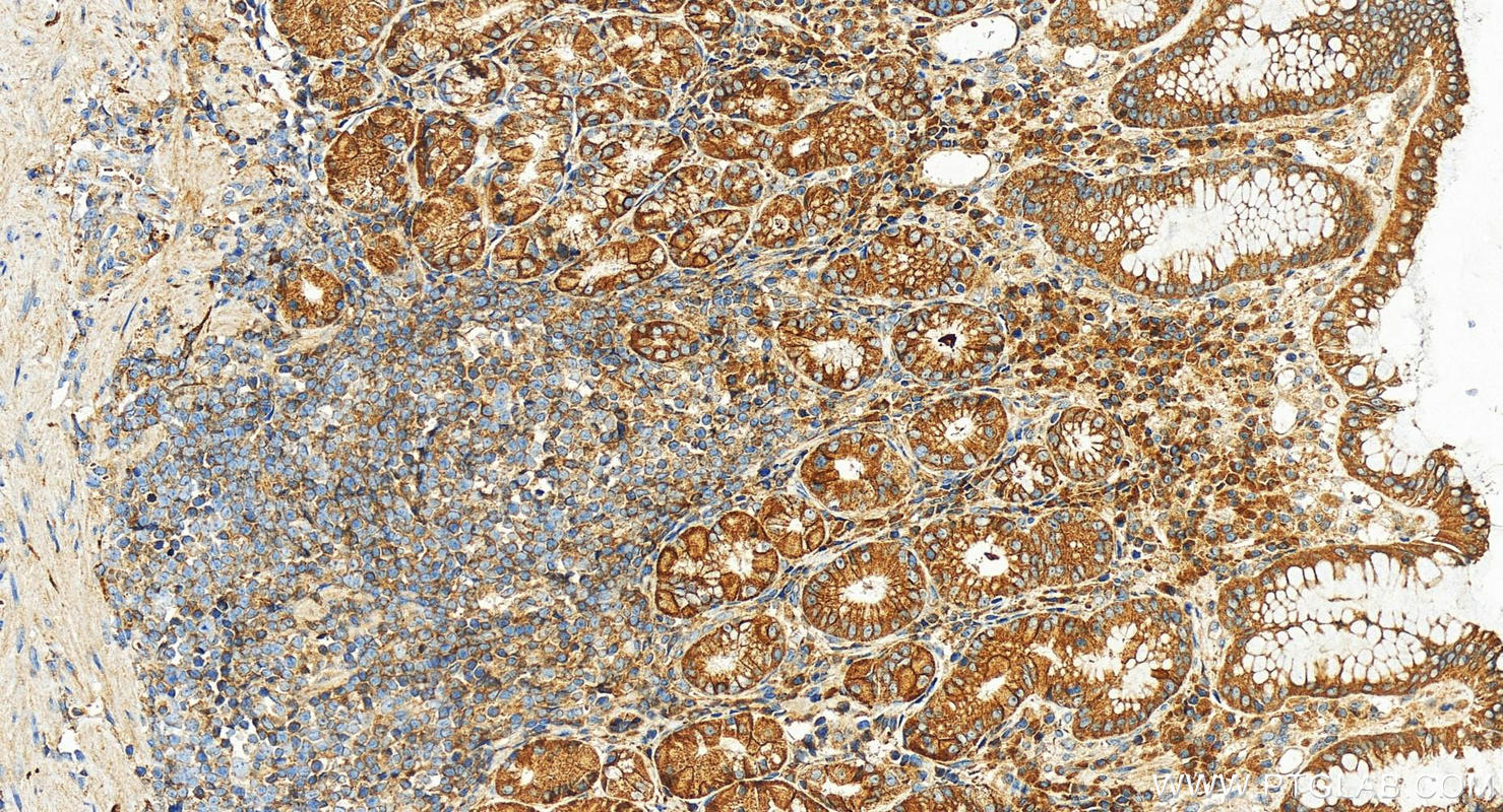 Immunohistochemistry (IHC) staining of human stomach tissue using PPP3CC-specific Polyclonal antibody (55163-1-AP)