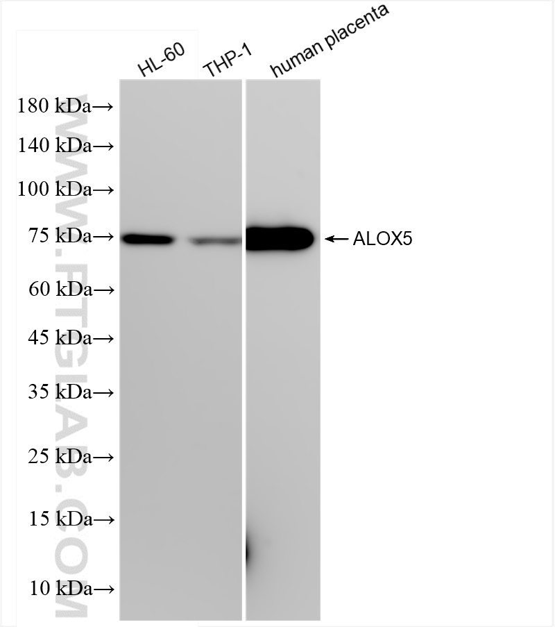 Western Blot (WB) analysis of various lysates using 5 Lipoxygenase Recombinant antibody (83794-4-RR)