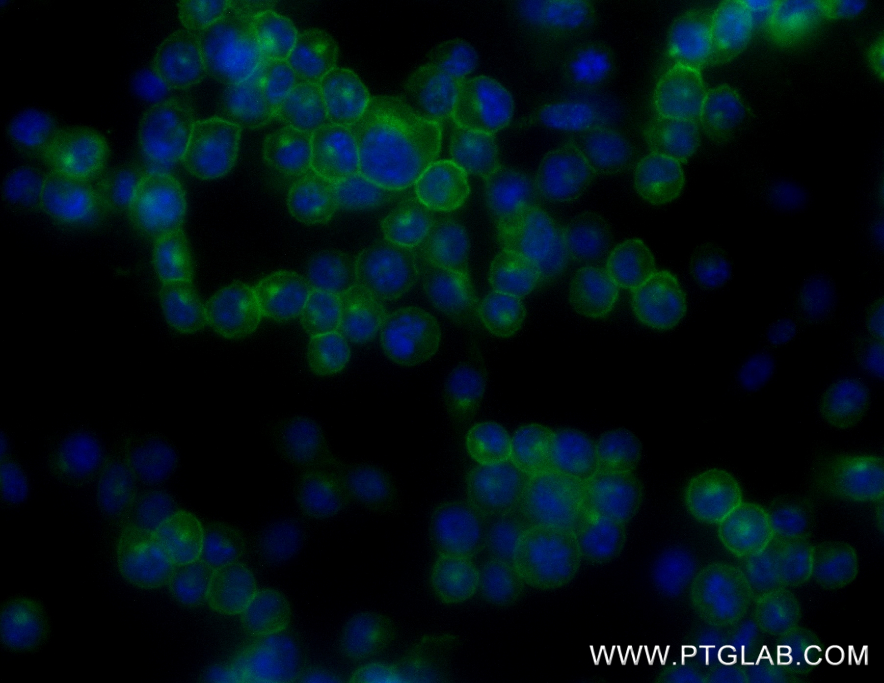 Immunofluorescence (IF) / fluorescent staining of 4T1 cells using CD73 Recombinant antibody (84434-4-RR)