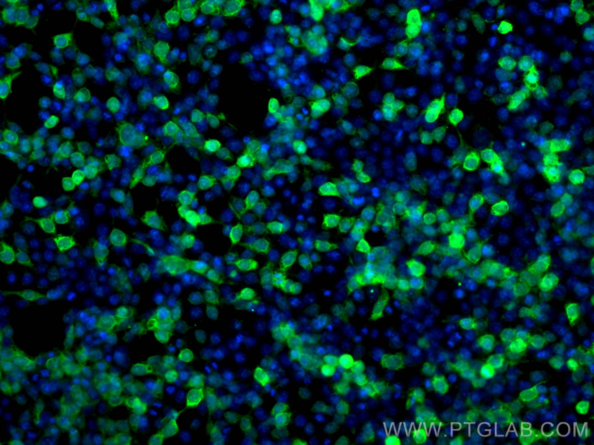 Immunofluorescence (IF) / fluorescent staining of Transfected HEK-293 cells using CoraLite® Plus 488-conjugated 6*His, His-Tag Monoc (CL488-66005)