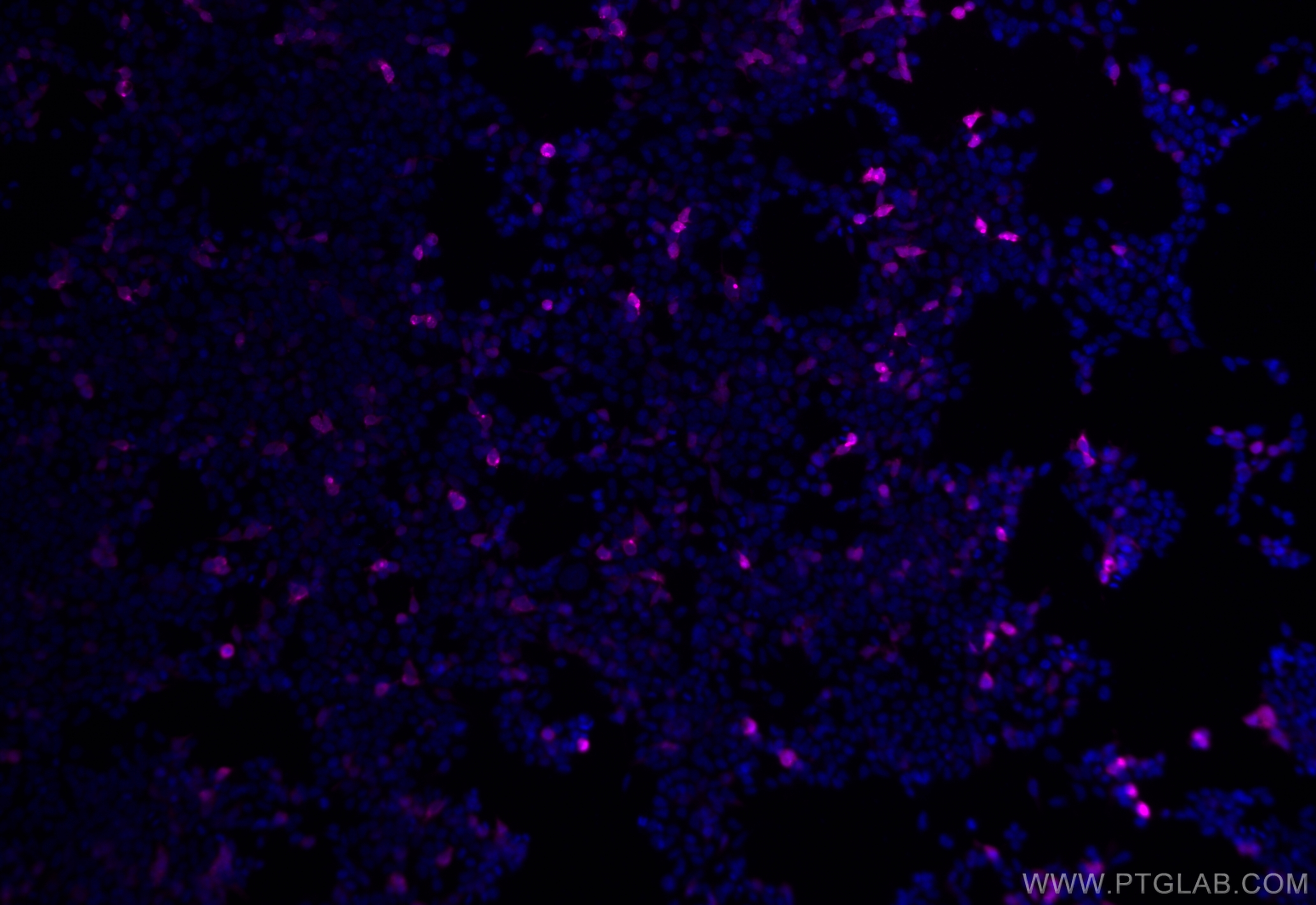 Immunofluorescence (IF) / fluorescent staining of Transfected HEK-293 cells using APC-conjugated 6*His, His-Tag Monoclonal antibody (APC-66005)