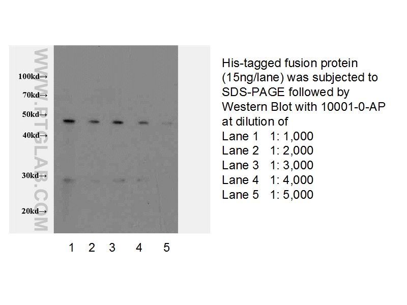 6*His, His-tag Antibody WB recombinant protein  10001-0-AP