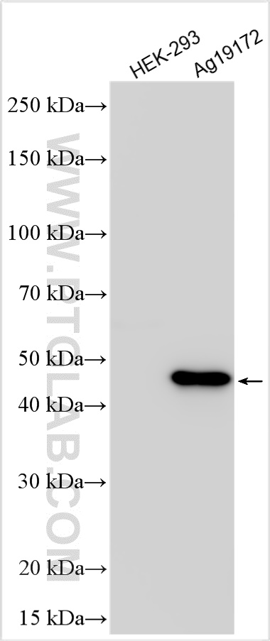 Western Blot (WB) analysis of various lysates using 6*His, His-tag Polyclonal antibody (10001-0-AP)